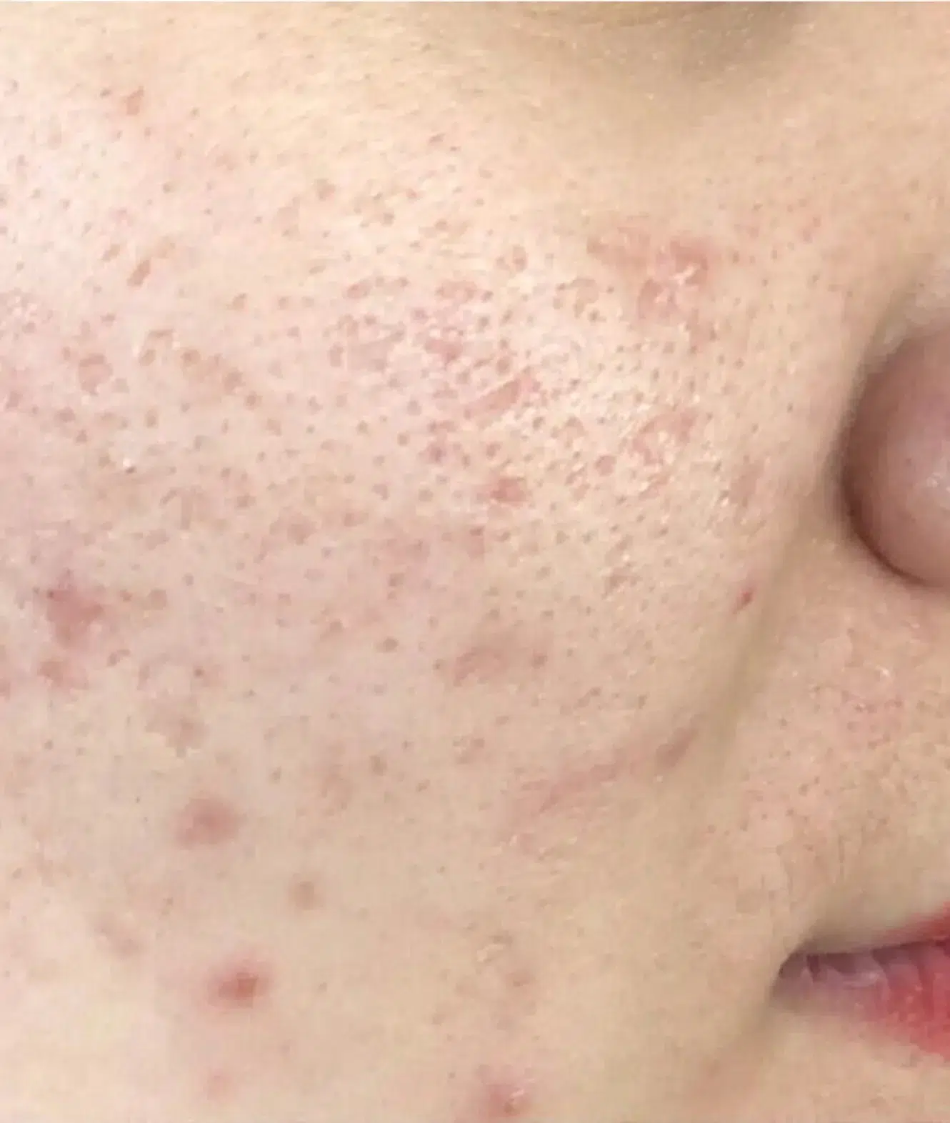 Dull Skin Tone — Before Treatment · Case 1 · Luowei Medical Aesthetics Clinic