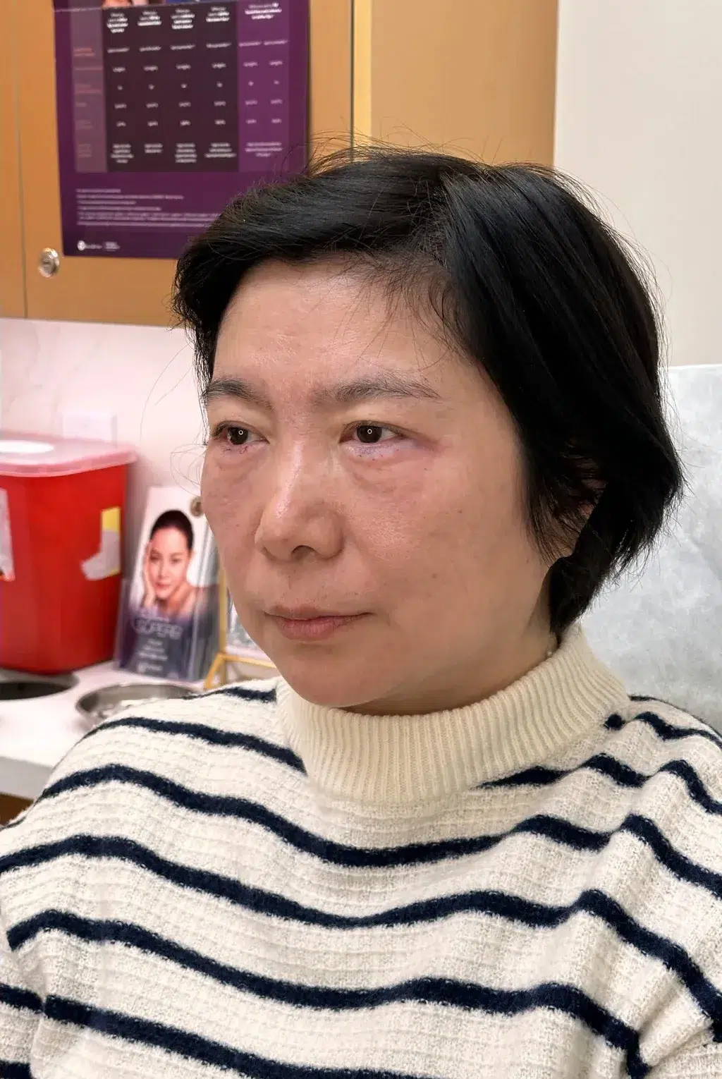 Tired, Aged & Fatigued Appearance — After Treatment · Case 02 · Luowei Medical Aesthetics Clinic