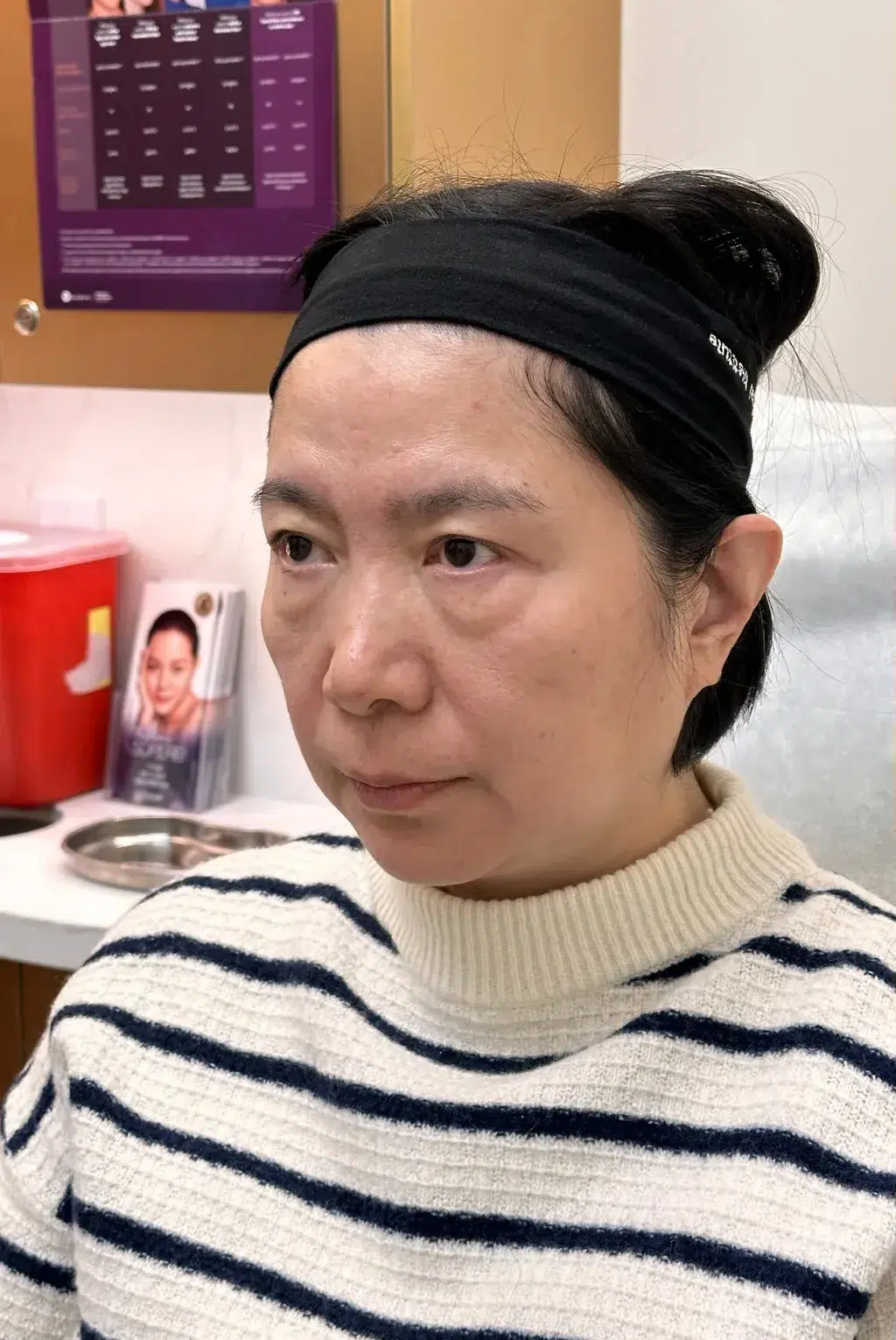 Tired, Aged & Fatigued Appearance — Before Treatment · Case 02 · Luowei Medical Aesthetics Clinic