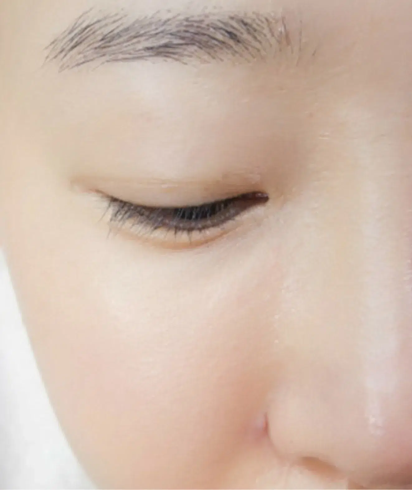 Pigmentation After · Case 04 · Luowei Medical Aesthetics Clinic