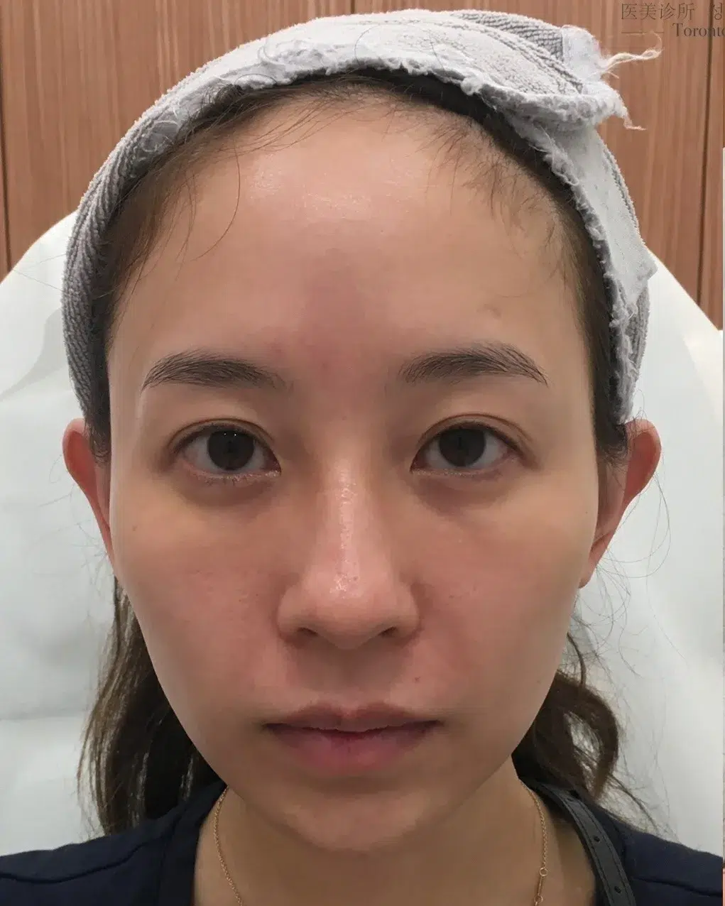 Tired, Aged & Fatigued Appearance — Before Treatment · Case 08 · Luowei Medical Aesthetics Clinic