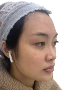 Luowei Skeletal Facial Contouring — After · Case 02 · Luowei Medical Aesthetics Clinic