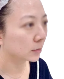 Luowei Skeletal Facial Contouring — After · Case 09 · Luowei Medical Aesthetics Clinic