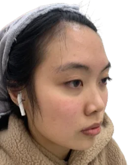 Luowei Facial Sculpturing · Before · Case 02 · Luowei Medical Aesthetics Clinic