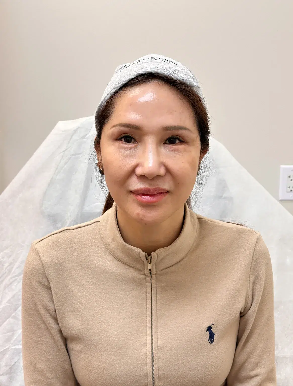 Luowei Skeletal Facial Contouring — After Treatment · Case 10 · Luowei Medical Aesthetics Clinic