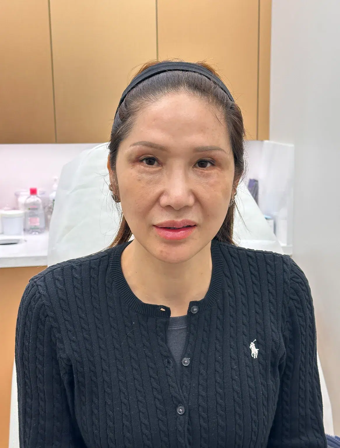 Luowei Skeletal Facial Contouring — Before · Case 10 · Luowei Medical Aesthetics Clinic