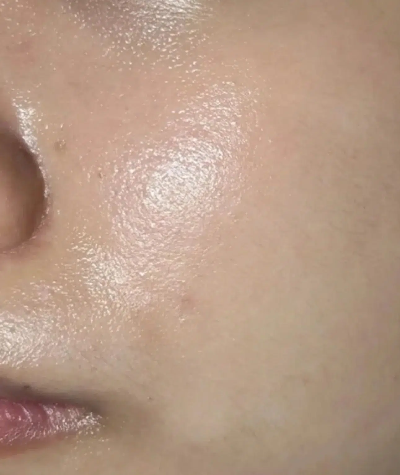 Treating uneven skin tone — After · Case 8 · Luowei Medical Aesthetics Clinic